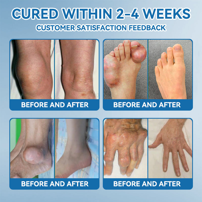LOTMAY® BPC-157 💙Joint & Muscle Treatment Cream🦴Treats Arthritis, Neuropathy, Rheumatism, Sports Injuries & More 🌹