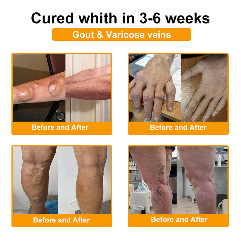 RAINDEW® BEE VENOM LITHOSPERMUM Pain-Relief Bone Healing Cream 👑👑(Specially for older adults)