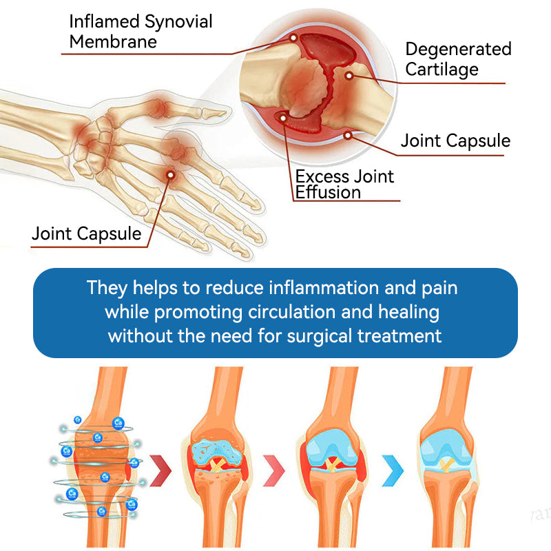 LOTMAY® BPC-157 💙Joint & Muscle Treatment Cream🦴Treats Arthritis, Neuropathy, Rheumatism, Sports Injuries & More 🌹