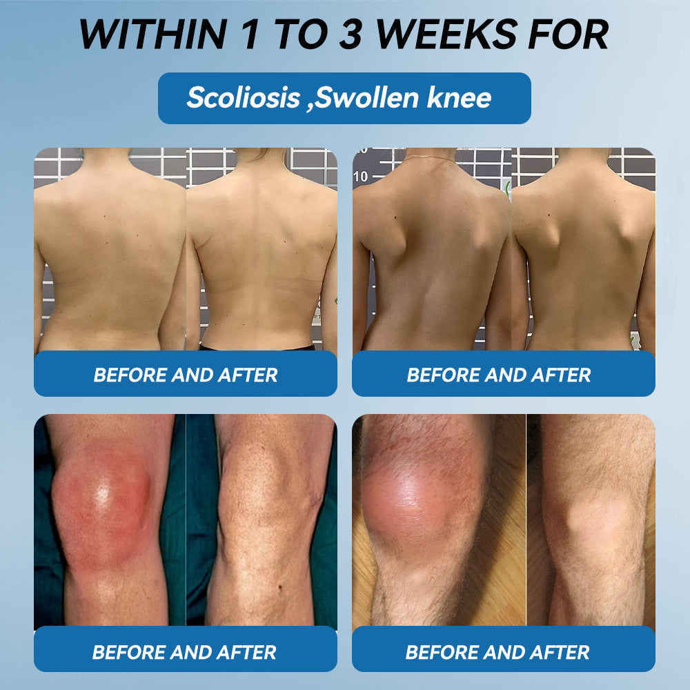 LOTMAY® BPC-157 💙Joint & Muscle Treatment Cream🦴Treats Arthritis, Neuropathy, Rheumatism, Sports Injuries & More 🌹