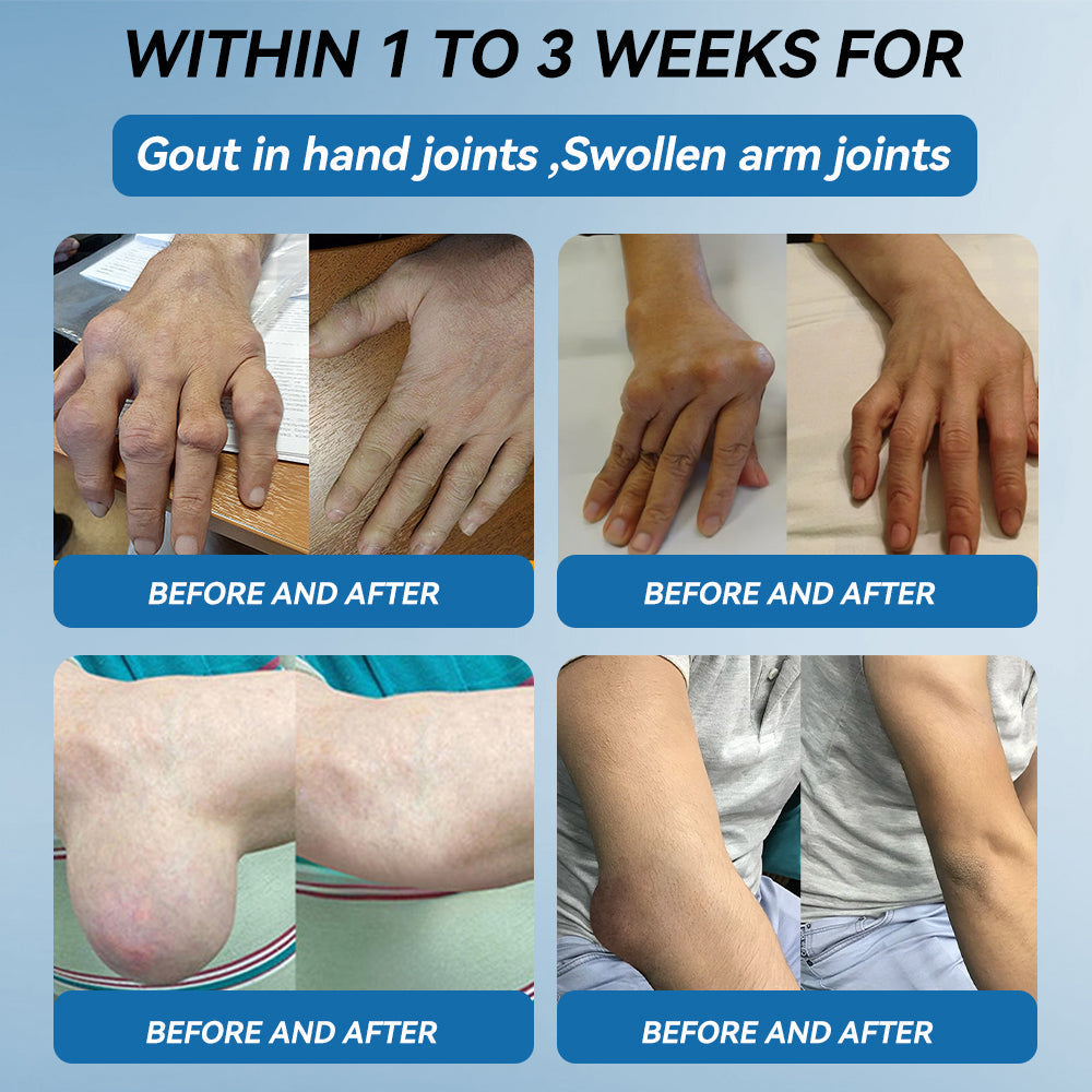 LOTMAY® BPC-157 💙Joint & Muscle Treatment Cream🦴Treats Arthritis, Neuropathy, Rheumatism, Sports Injuries & More 🌹