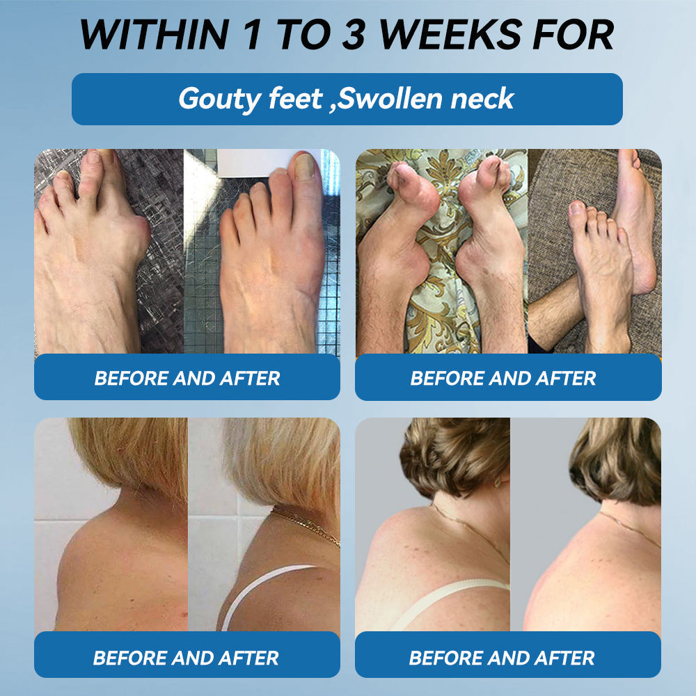LOTMAY® BPC-157 💙Joint & Muscle Treatment Cream🦴Treats Arthritis, Neuropathy, Rheumatism, Sports Injuries & More 🌹