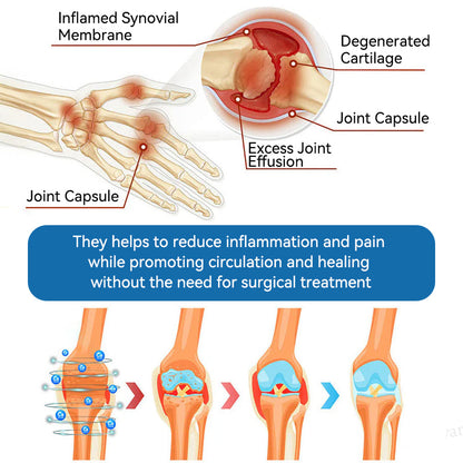 LOTMAY® BPC-157 💙Joint & Muscle Treatment Cream🦴Treats Arthritis, Neuropathy, Rheumatism, Sports Injuries & More 🌹