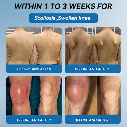 LOTMAY® BPC-157 💙Joint & Muscle Treatment Cream🦴Treats Arthritis, Neuropathy, Rheumatism, Sports Injuries & More 🌹